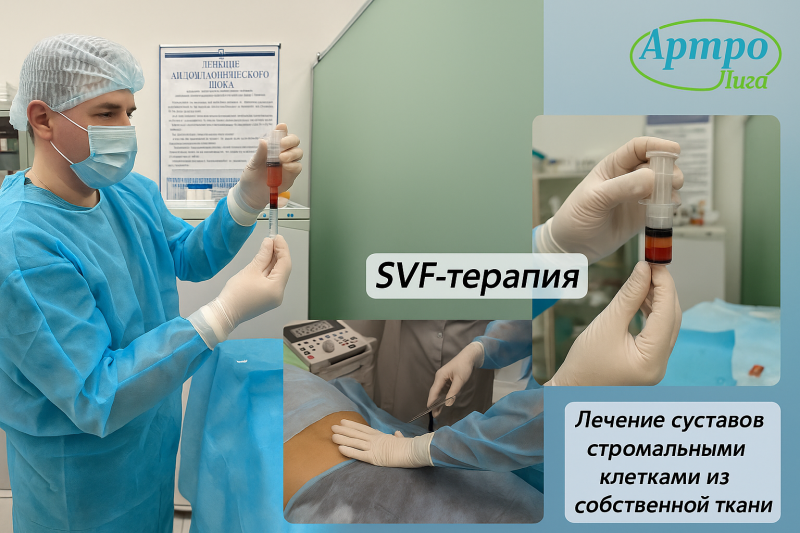 SVF-терапия в МЦ Артролига: восстановление суставного хряща при хондромаляции