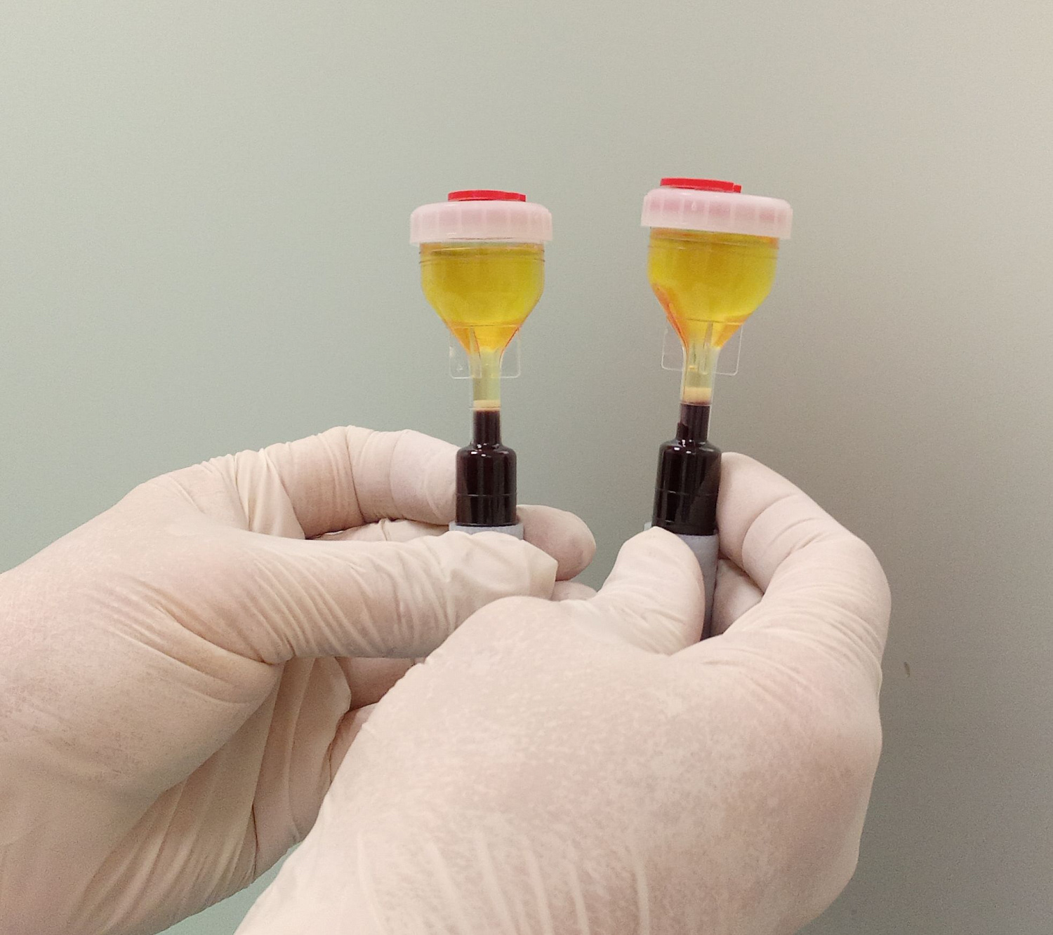 Восстановление суставов